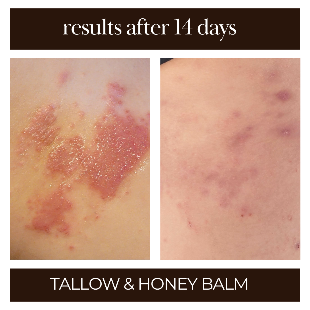 Tallow & Honey Balm